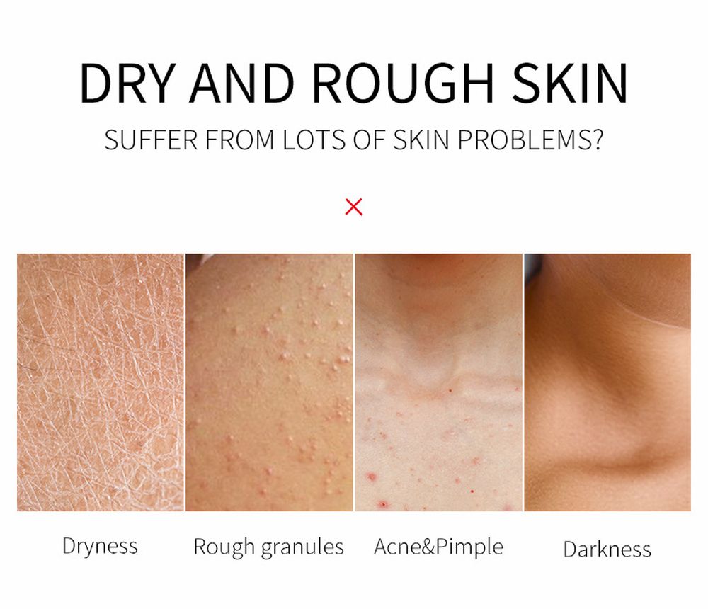 (Hàng Mới Về) Gel Tẩy Tế Bào Chết Chiết Xuất Bơ Hạt Mỡ Laikou | BigBuy360 - bigbuy360.vn