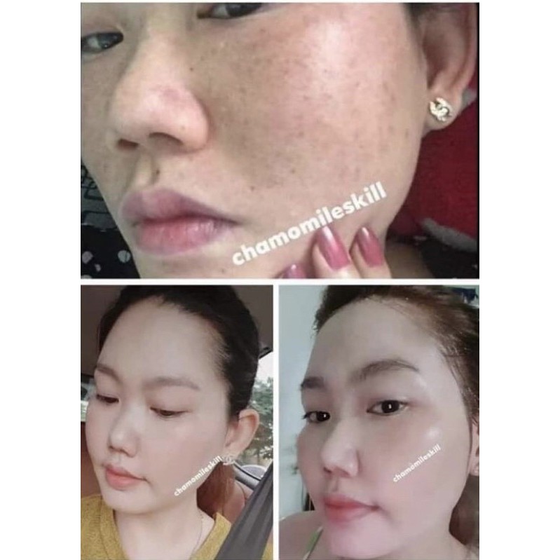 Kem tái tạo chamomile