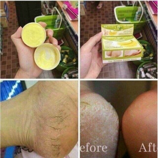 Kem Hổ Trợ Nứt Gót Chân Chuối Thái Lan