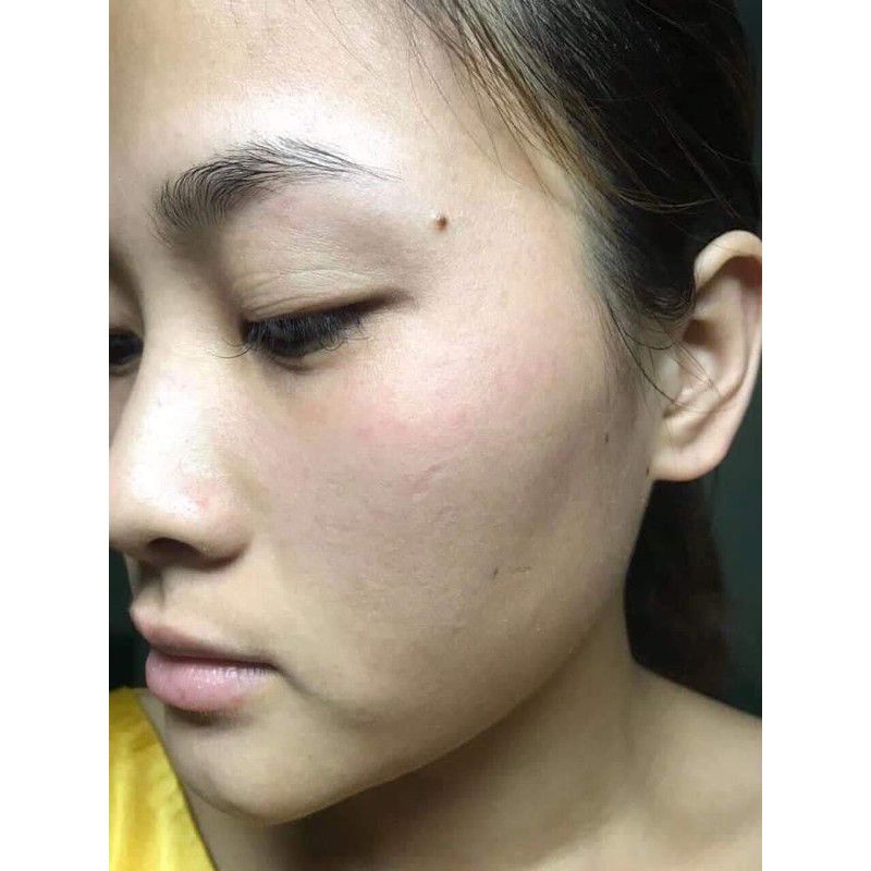 Combo sản phẩm tảo sống chấm nám tàn nhang+kem phục hồi.B3.