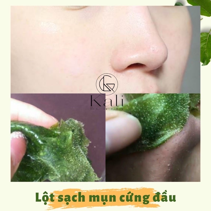 Lột Mụn Trà Xanh KALI 100 % Thiên Nhiên
