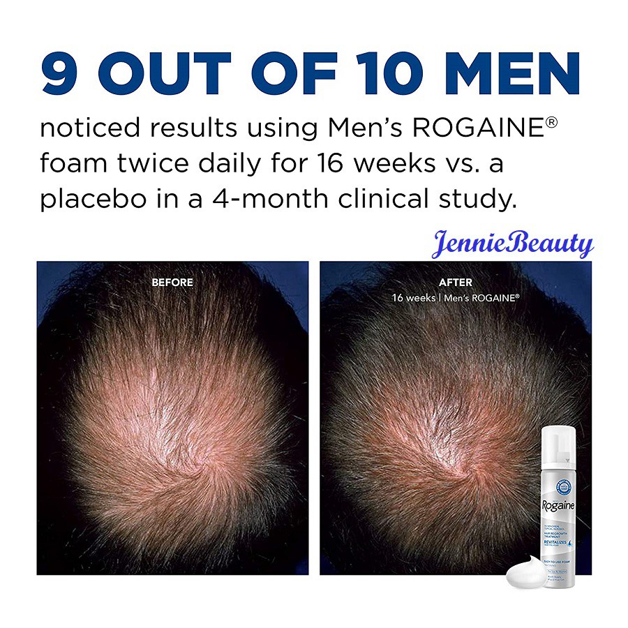 Kem mọc tóc Nam Rogaine Minoxidil 5% Foam For Men 60ml