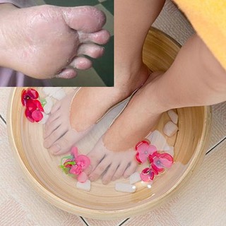 BỘT NGÂM CHÂN TAY TRỊ Á SỪNG 100%