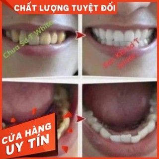 Trắng răng T WHITE