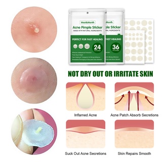 Miếng Dán Hỗ Trợ Giảm Mụn Clear Spot Patch 36 Miếng