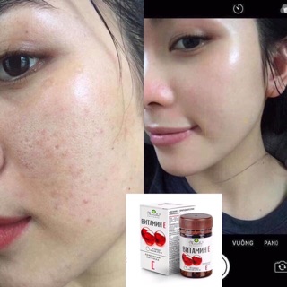 Vitamin E đỏ nga 270mr mẫu mới