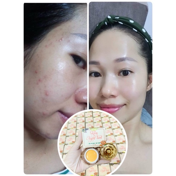 KEM FACE NGHỆ TƯƠI 15gram