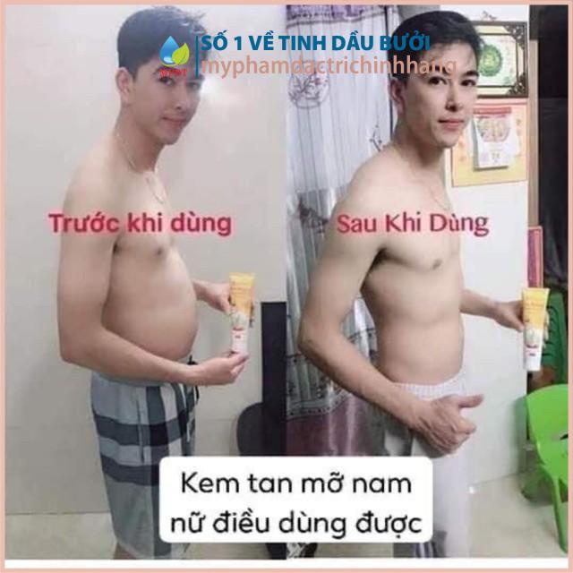 Kem tan mỡ Ngân Bình làm giảm mỡ bụng sau sinh, mỡ đùi, bắp tay, mỡ thừa trên cơ thể nhanh chóng, da săn chắc