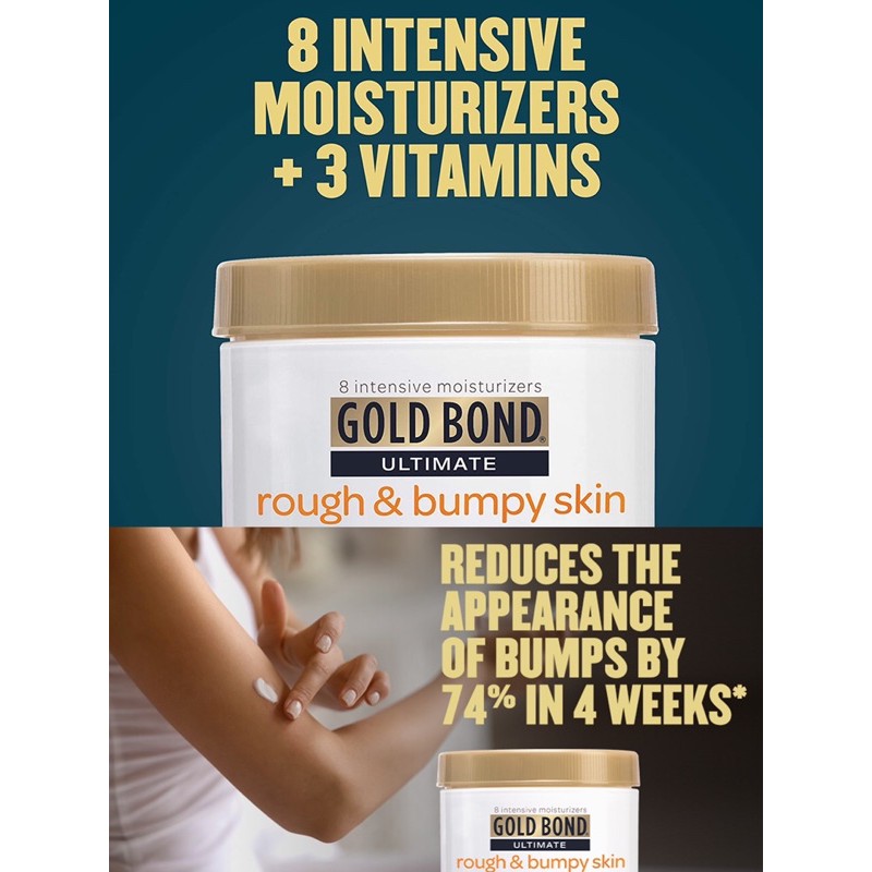 Allbyvy  KEM DƯỠNG BODY GOLD BOND