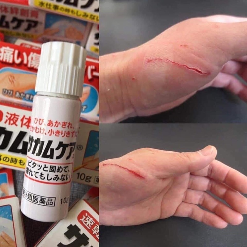 Gel đứt tay 10g Kobayashi Nhât