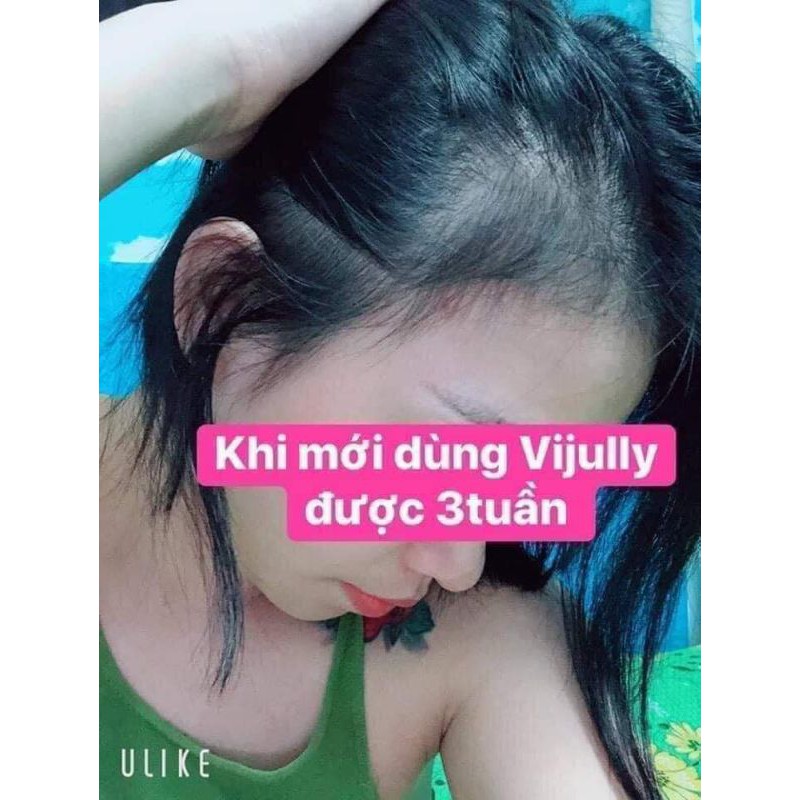 Chính Hãng Xịt Tinh Dầu Bưởi Vịully Natural Ngăn Rụng, Kích Mọc,Phục Hồi hư Tổn. ( tặng quà xinh) | BigBuy360 - bigbuy360.vn