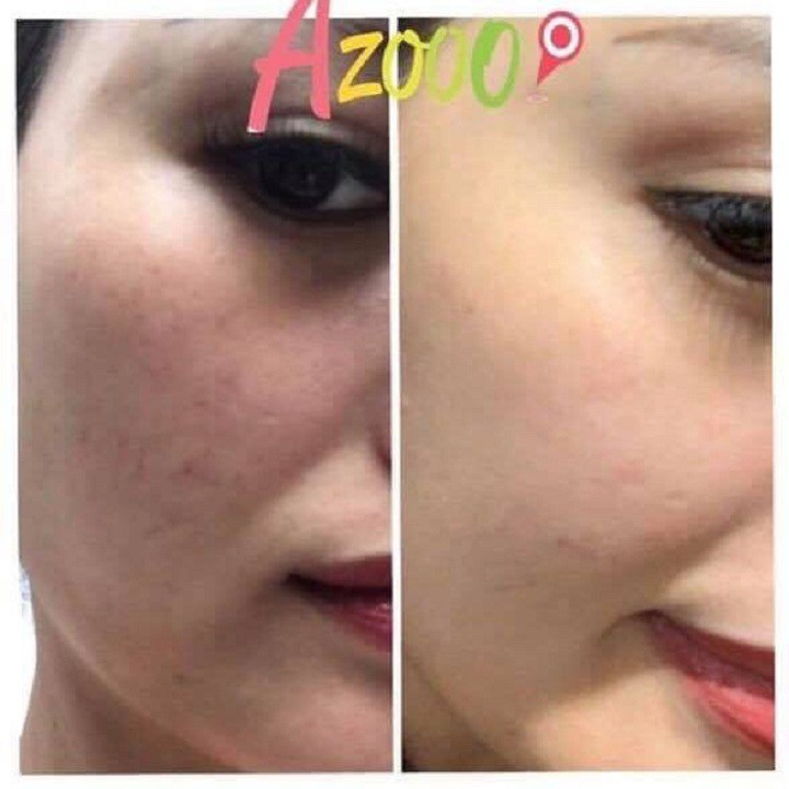 TINH CHẤT TẨY ĐỐM NÂU, TÀN NHANG BLANCHIR 45ml | BigBuy360 - bigbuy360.vn