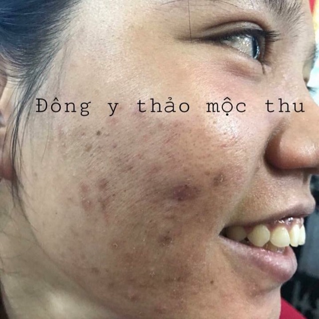 Đông Y Thảo Mộc Thu