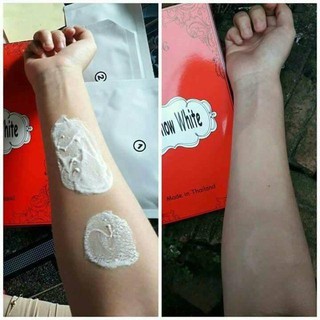Tắm Trắng Pure Snow White