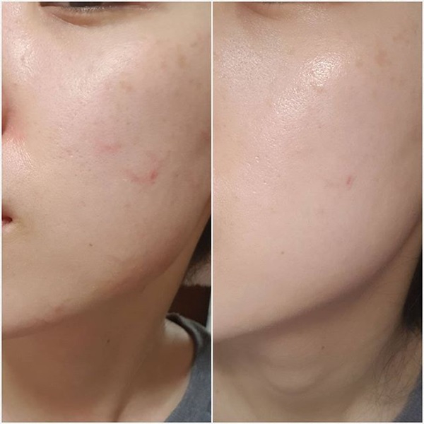 Kem Chống Nắng Skin1004 Madagascar Centella Air-fit Suncream SPF50+ PA+ 50ml