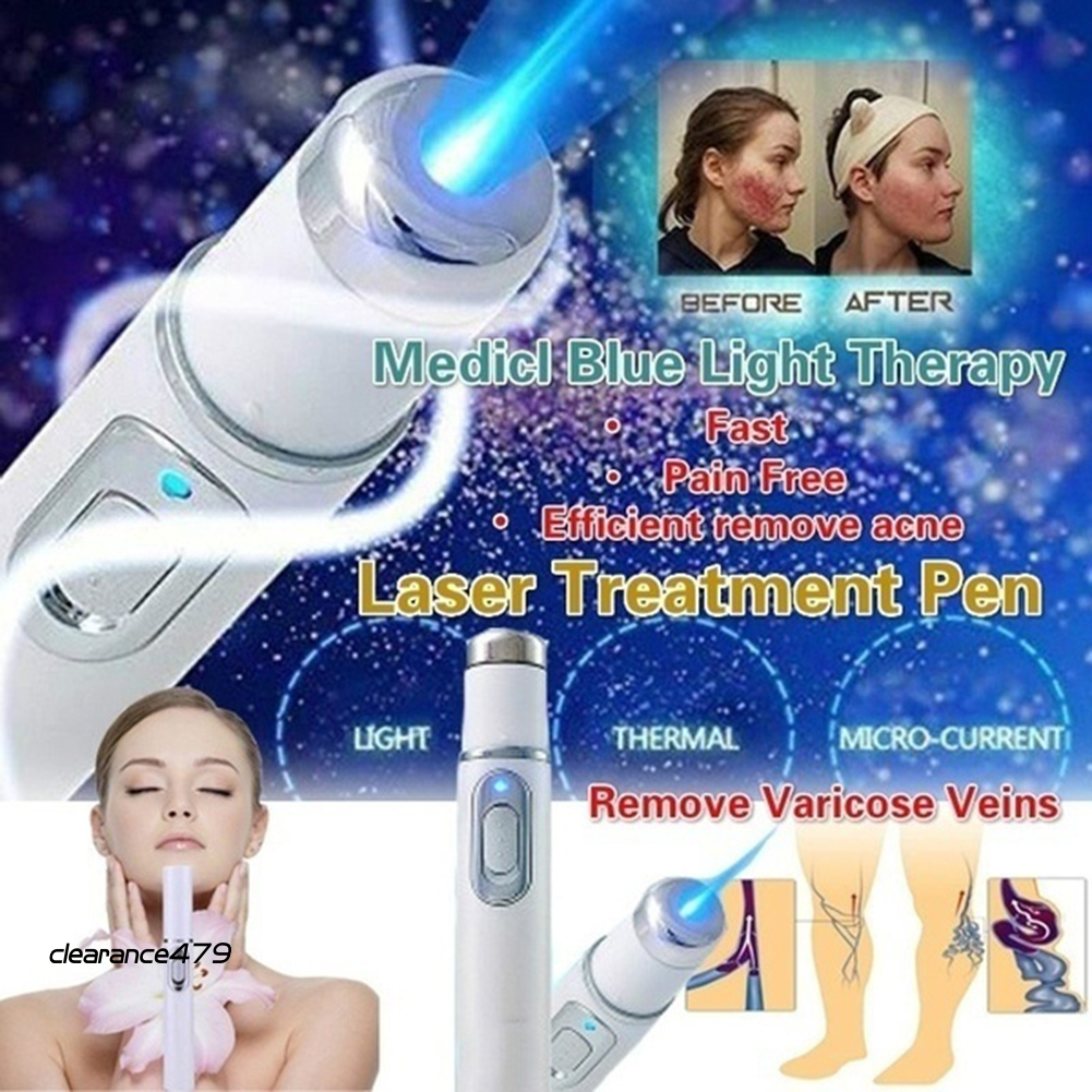 (Hàng Mới Về) Bút Laser Trị Mụn / Tàn Nhang / Vết Thâm Sử Dụng Công Nghệ Ánh Sáng Xanh Lam 479