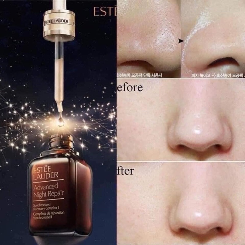 Tinh chất phục hồi da Estee Lauder Advanced Night Repair Serum 7ml/ 15ml/ 50ml