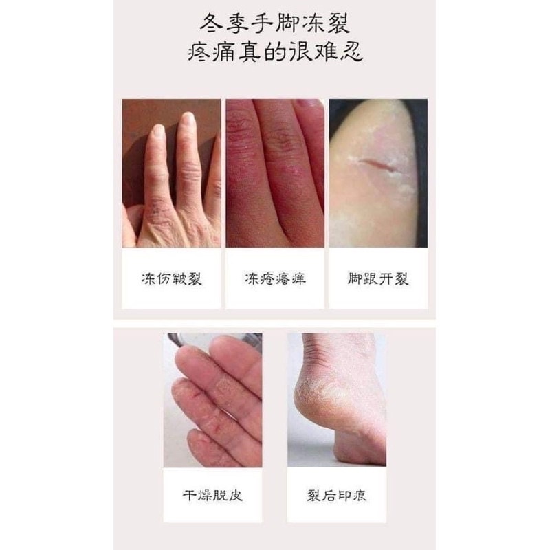 Kem Ngựa Bôi Chống Nứt Nẻ Tay Chân,Dưỡng Ẩm Cho Da,Chăm Sóc Da Hiệu Quả