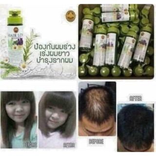 Dầu gội kích thích mọc tóc thái lan