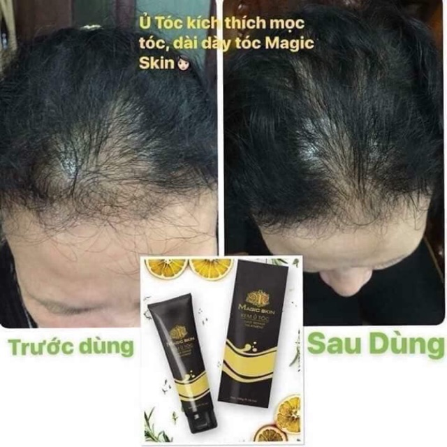 Ủ TÓC MAGIC SKIN