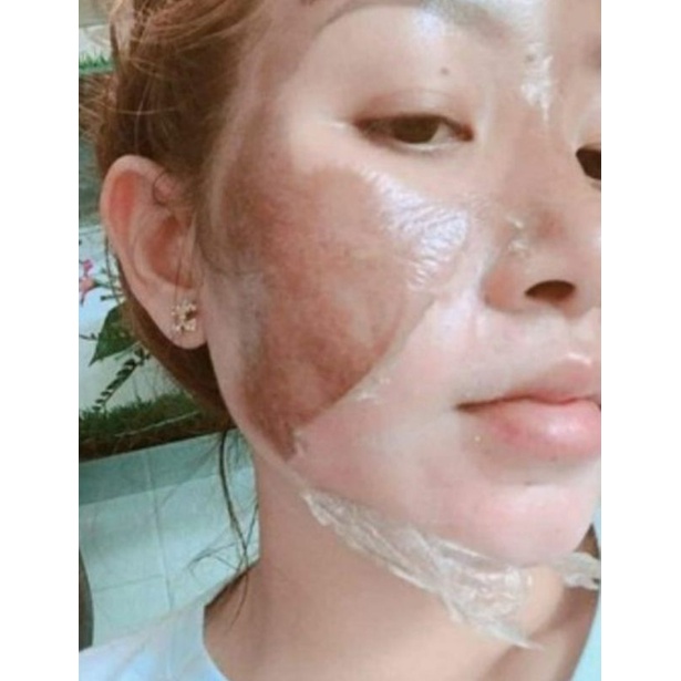 Lột Da Mặt Sinh Học BEZY Thái lan – mẫu mới 2022