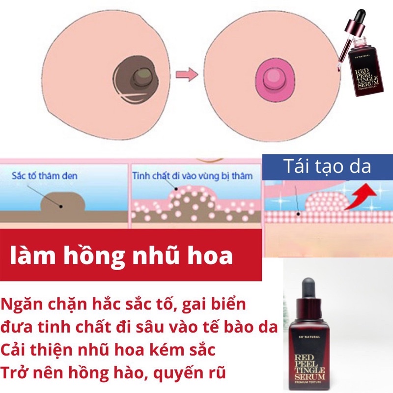 Red Peel Tingle Serum Premium 20ml tinh chất tái tạo peel da sinh học, trắng da, giảm mụn So Natural chính hãng Hàn Quốc