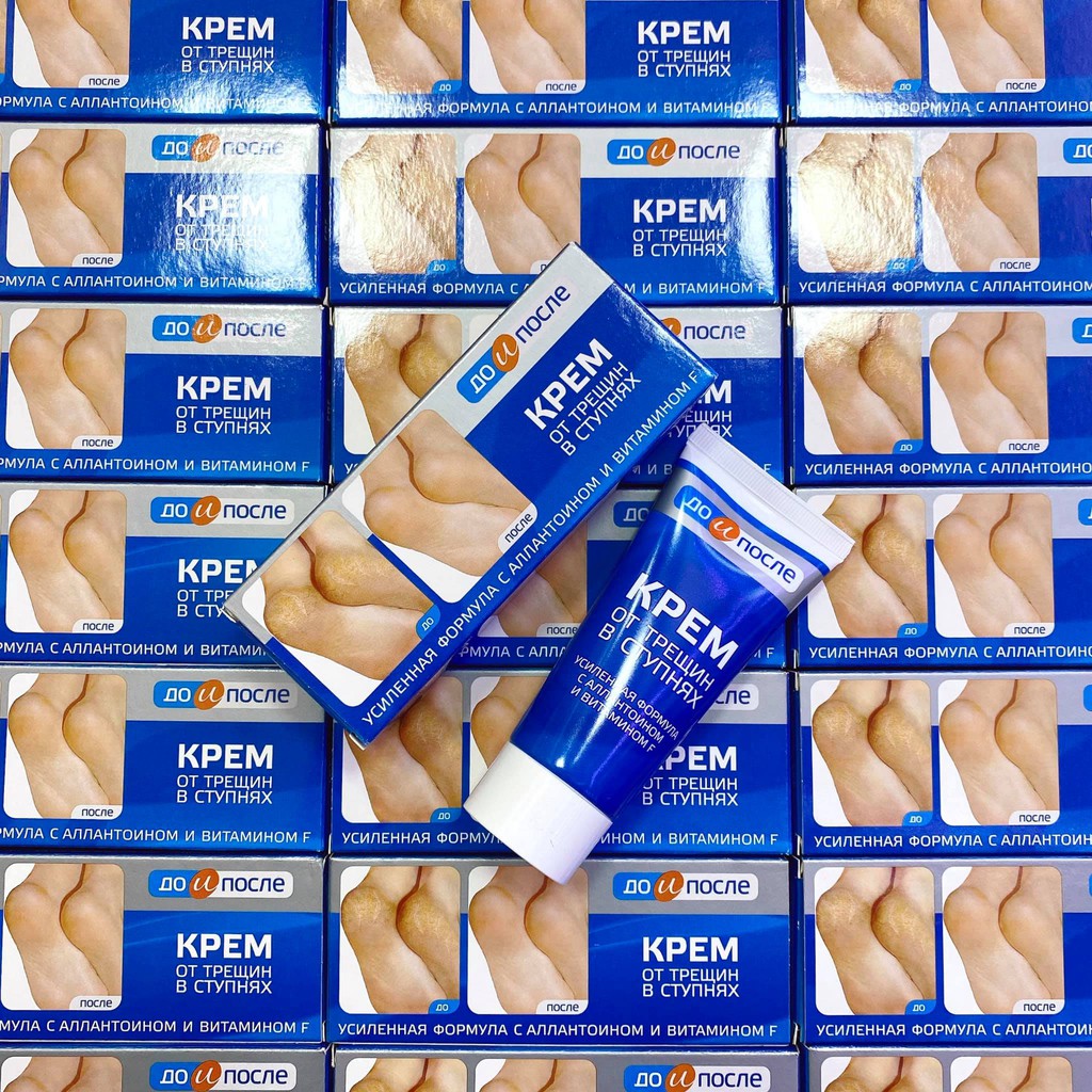 Kem Trị Nứt Gót Chân KPEM Nga