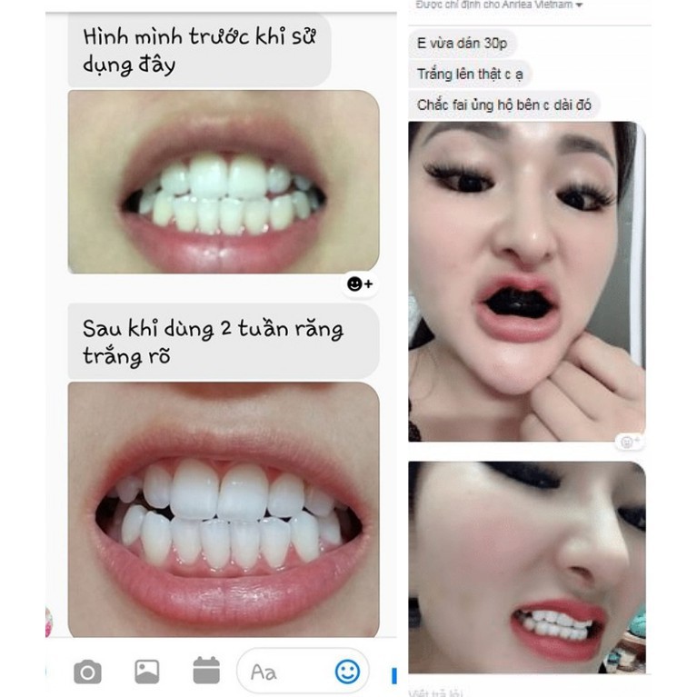 [LIỆU TRÌNH 7 NGÀY TẶNG 1 MIẾNG DÁN] - Miếng Dán Trắng Răng Anriea Black Tooth Whitening - 30 Minutes Express- A02.03