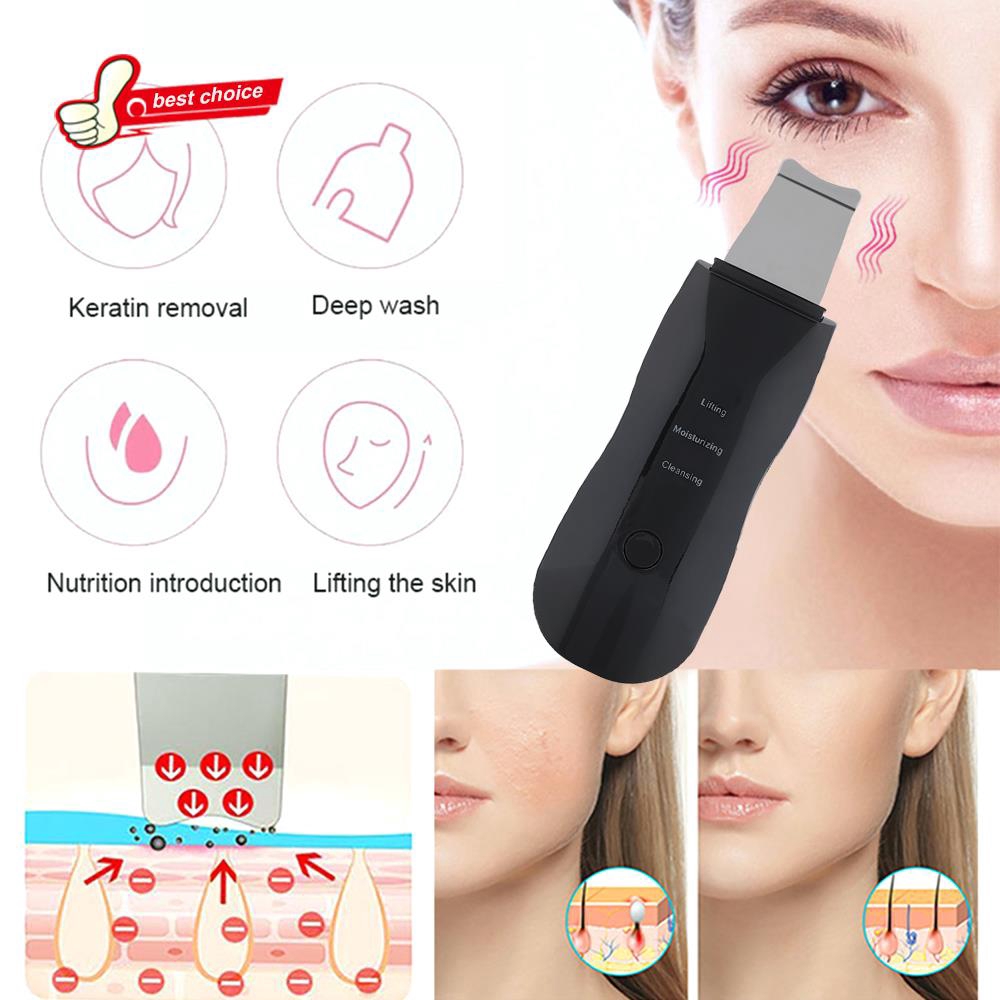 Máy cà da hút mụn làm đẹp hiệu quả màu đen | BigBuy360 - bigbuy360.vn