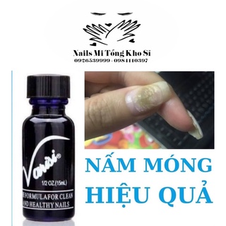 Dưỡng móng chống nấm,kem bôi nấm móng tay chân virasi