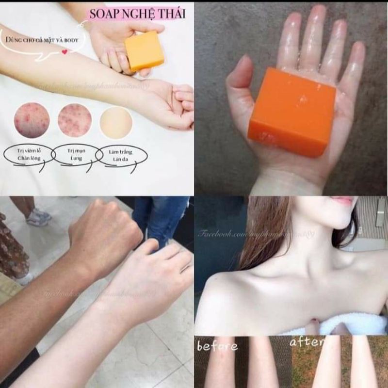 Xà phòng rửa mặt và tắm kích trắng | BigBuy360 - bigbuy360.vn