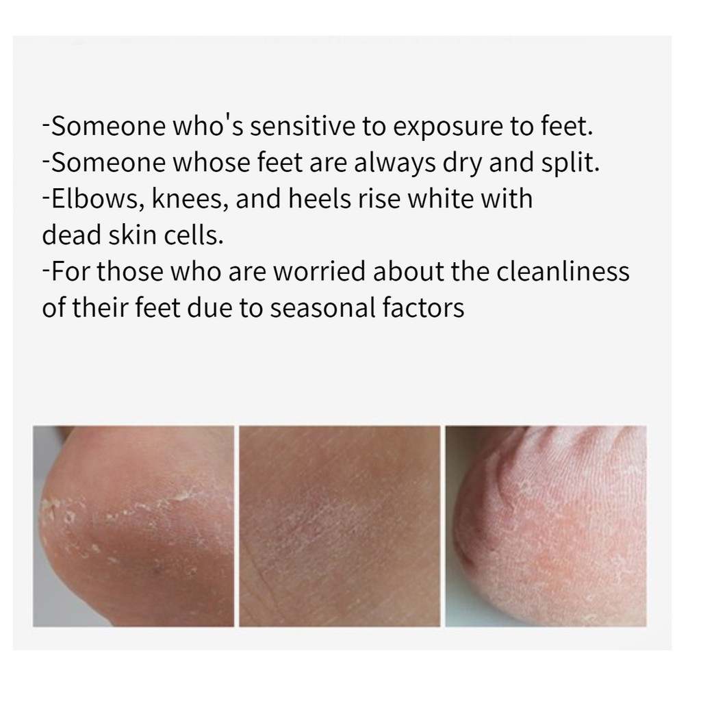 Kem dưỡng ẩm tẩy tế bào chết cho bàn chân 30g*1ea/care/kerasal intensive
