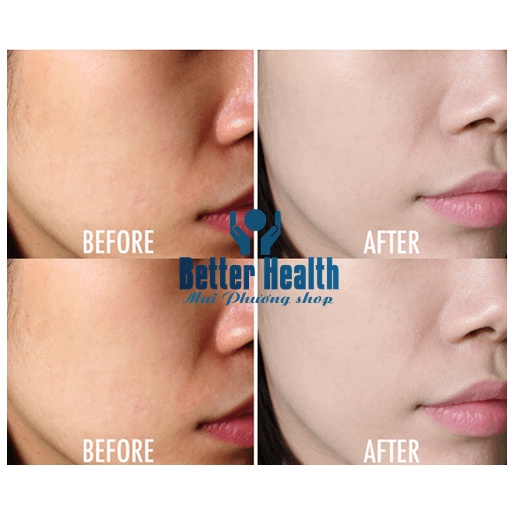 Kem dưỡng da NHAU THAI CỪU Lanolin Careline Của Úc | BigBuy360 - bigbuy360.vn