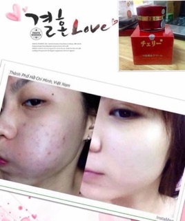 KEM FACE HOA ANH ĐÀO 10 TÁC DỤNG