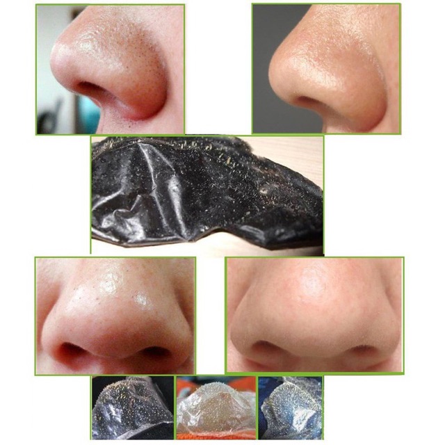 Miếng lột mụn mũi | BigBuy360 - bigbuy360.vn