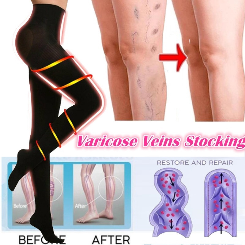 Vớ Nén Chân Chống Giãn Tĩnh Mạch Thoáng Khí Giúp Tuần Hoàn Máu