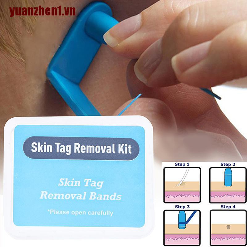 [Yuanzhen1] 20 Dây Cao Su Loại Bỏ Mụn Cóc Không Độc Hại Chăm Sóc Da Mặt