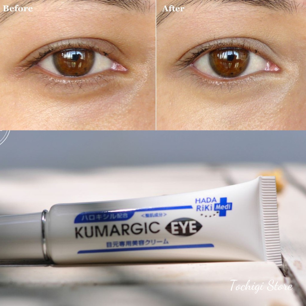 Kem thâm quầng mắt Kumargic Eye Cream Nhật Bản - Hộp 20g