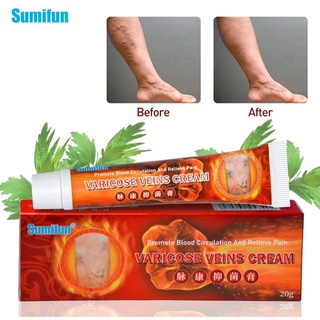 Kem bôi da suy giãn tĩnh mạch hiệu quả