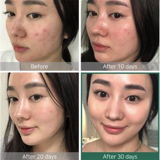 Toner SOME BY MI AHA-BHA-PHA 30Days Miracle