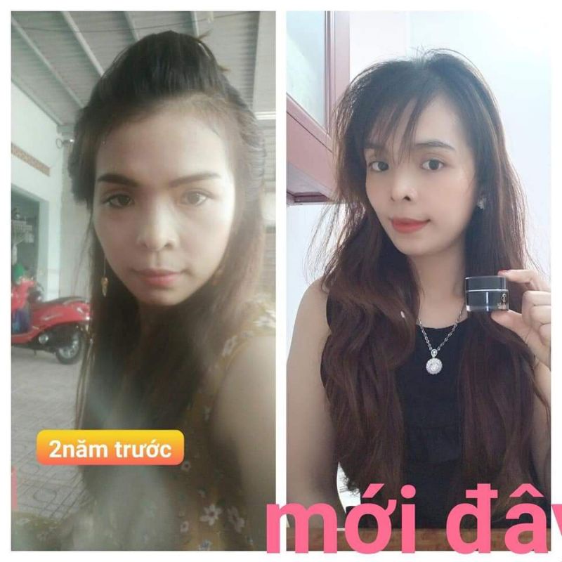 kem dưỡng trắng da