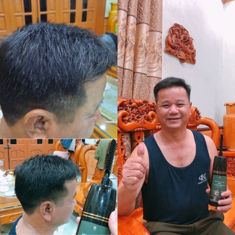 [ Chính hãng HCM] Dầu gội phủ bạc LACO - Lên màu đen sau 9 phút
