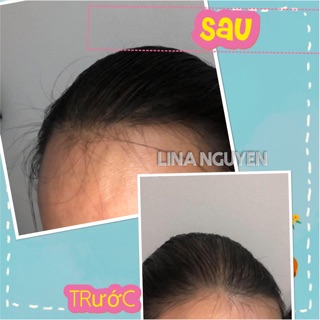 Bộ sản phẩm chăm sóc tóc Bưởi Rừng TB.D’aboard