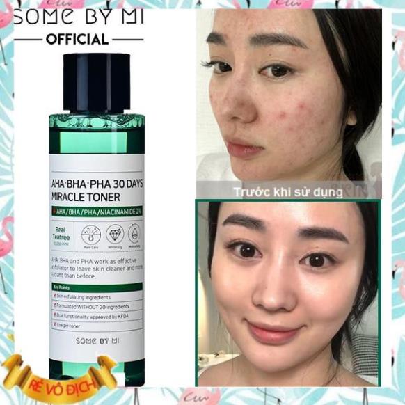 🌸 Some By Mi AHA- BHA-PHA 30 Days Miracle Toner - Nước Hoa Hồng Cho Da Mụn 150ml