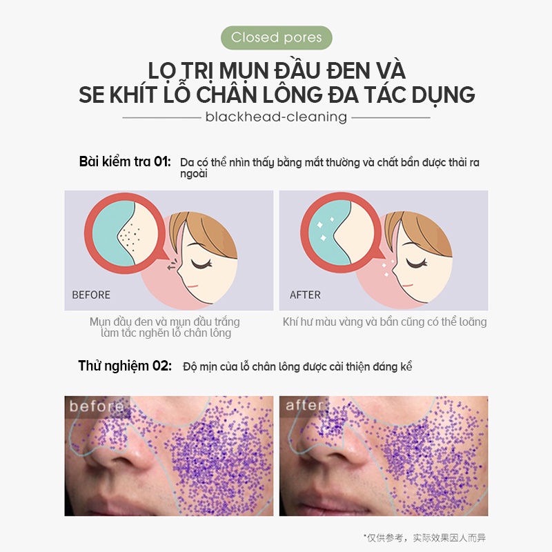 Mặt nạ IMAGES bùn trà xanh MMZ061 loại bỏ mụn đầu đen làm săn chắc da mặt 100g