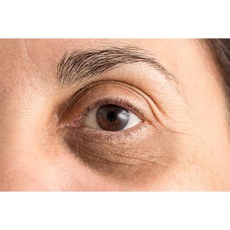 Viên nang giúp cải thiện đáng kể tình trạng Bọng/ túi mắt và quầng thâm và nếp nhăn | BigBuy360 - bigbuy360.vn