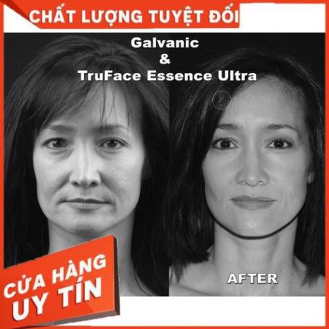 Combo 10 viên giọt nước thần tru face nuskin