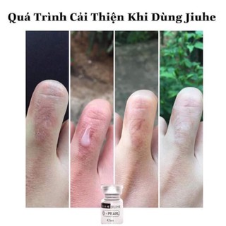 SERUM JIUHE THÂM BYE BYE MELANO