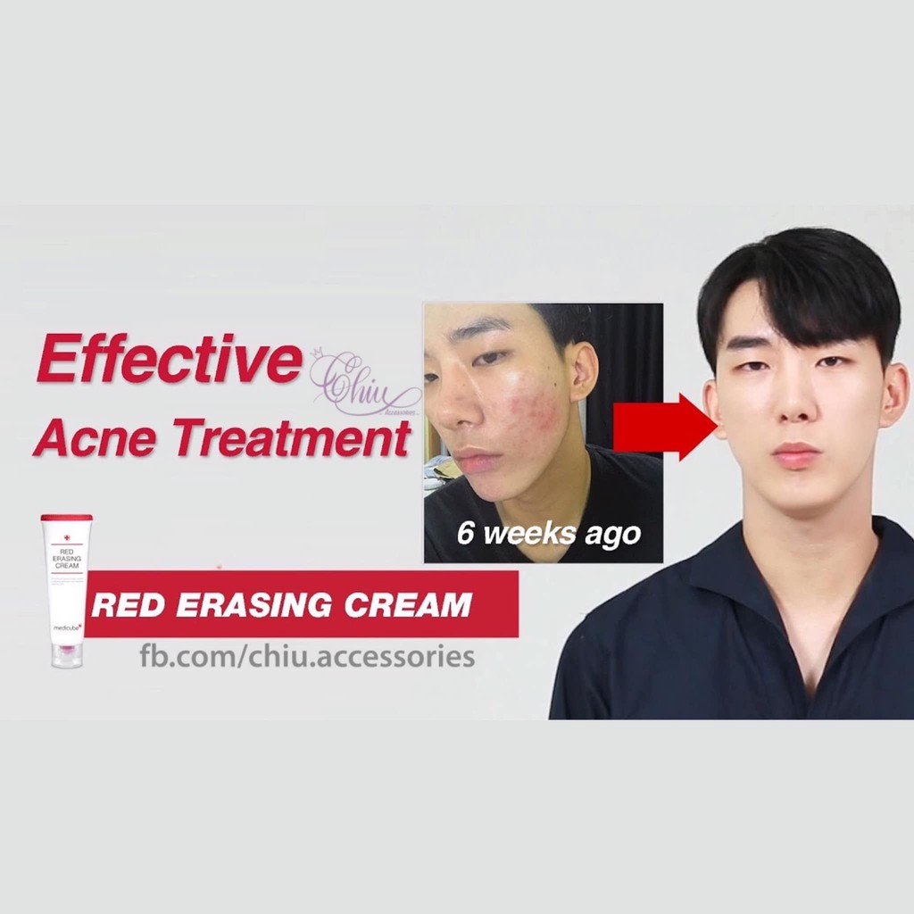 Kem Dưỡng Trắng Trị Thâm Mụn Liền Sẹo Medicube Red Erasing Cream 50ml