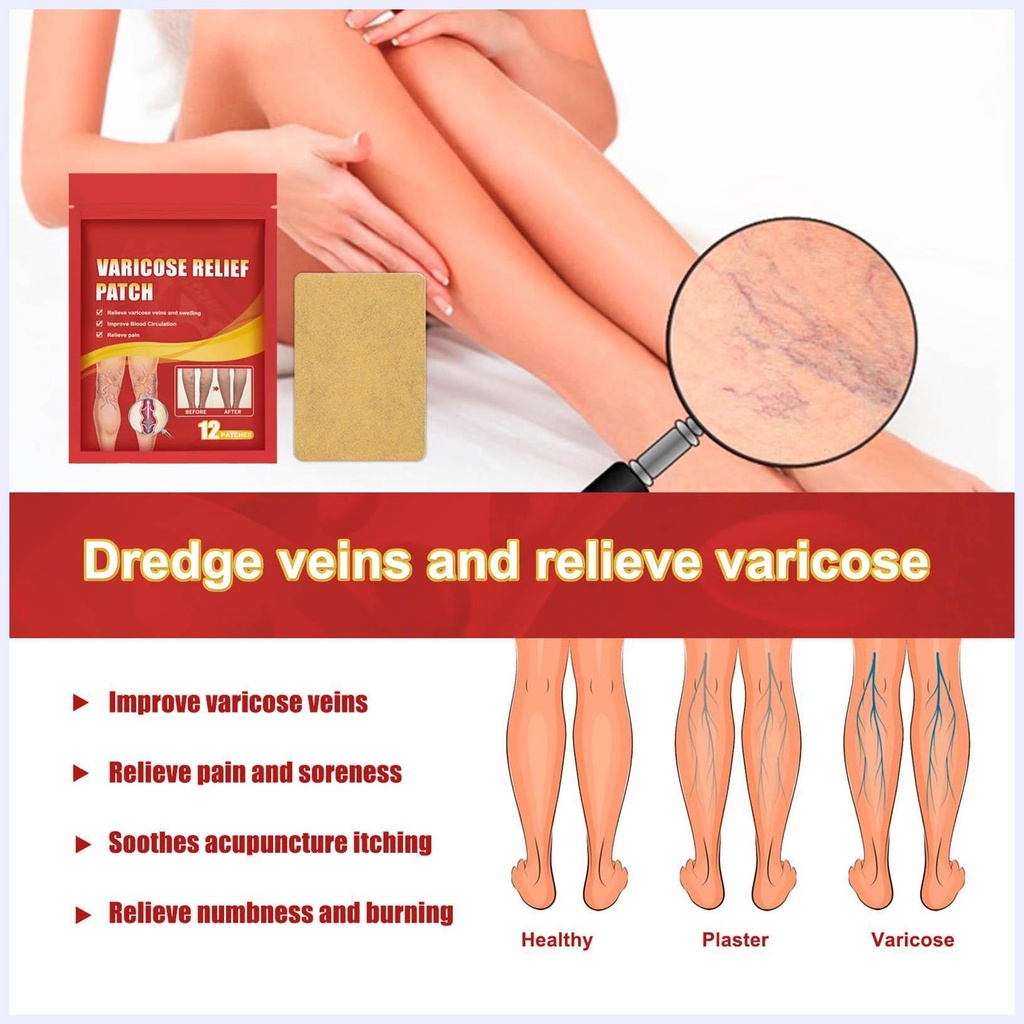 Miếng dán giảm giãn tĩnh mạch 12 miếng sửa chữa tĩnh mạch chân phồng lên bằng giun đất sưng đau chân